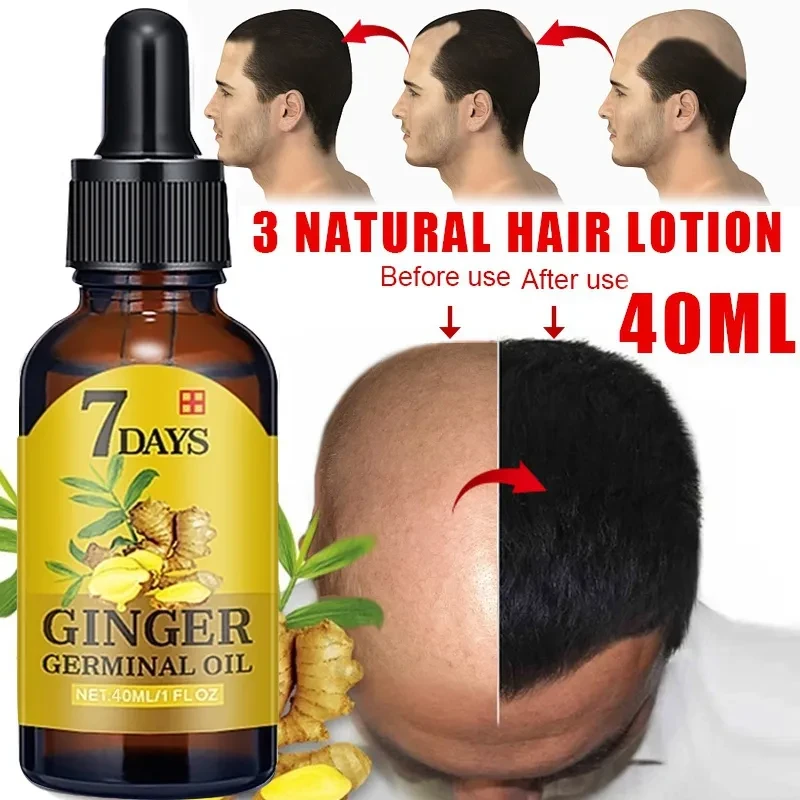 Ginger Hair Growth Serum (আদার হেয়ার গ্রোথ সিরাম) | Stop Hair Loss